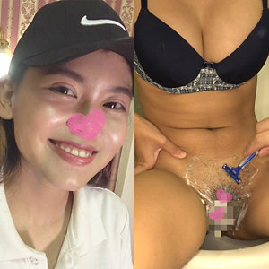 【完全版】merc376｜スーちゃん【みなみ工房】